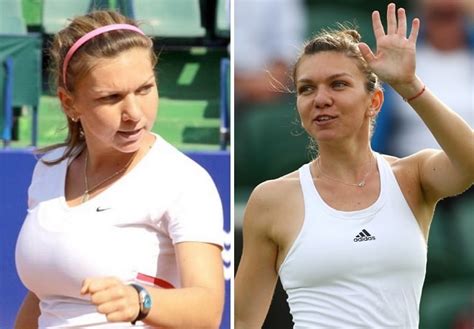 Simona Halep Before and After Breast Reduction Surgery